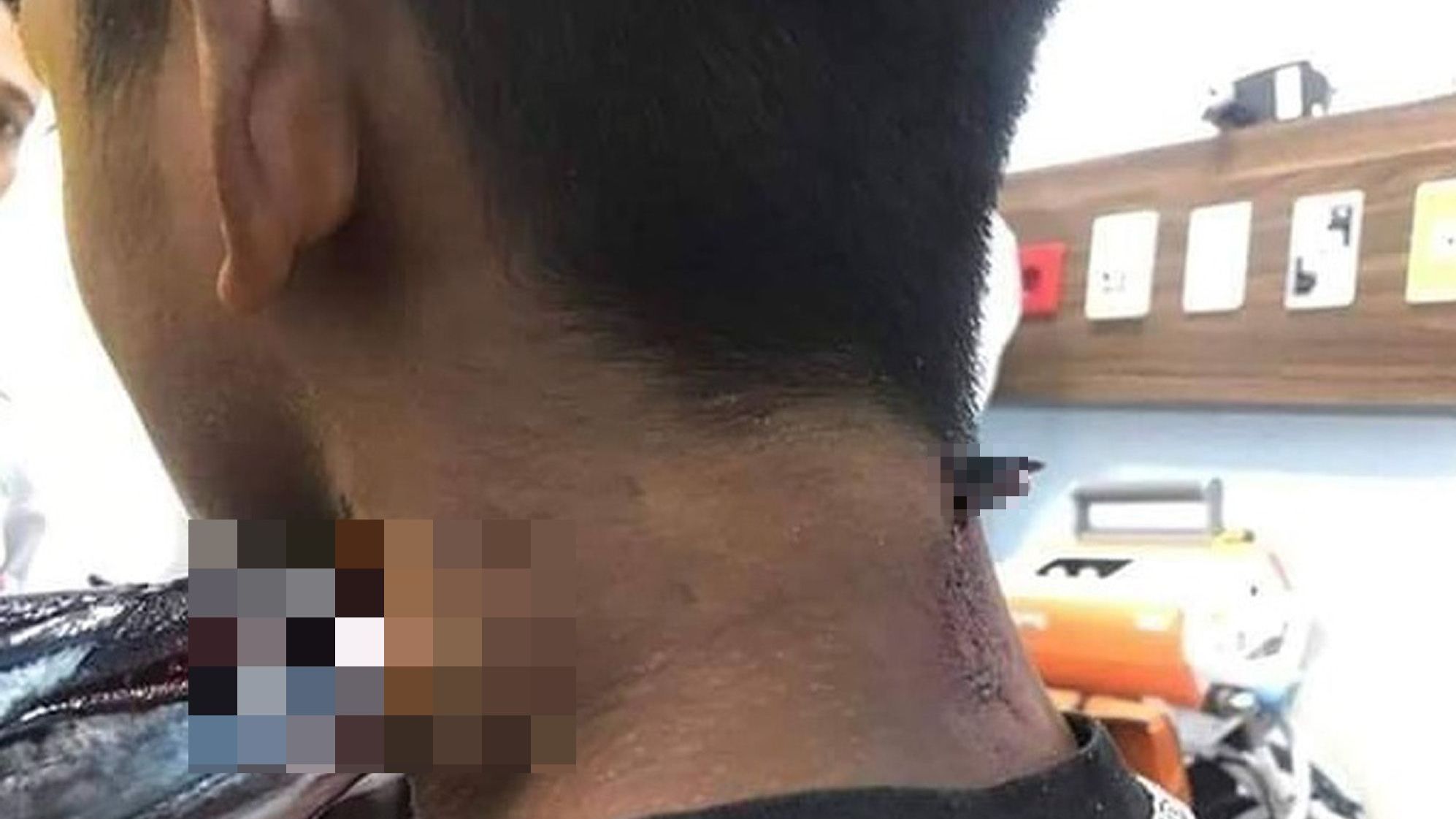 Риба стрибнула в човен і наскрізь проткнула рибалці шию: фотофакт