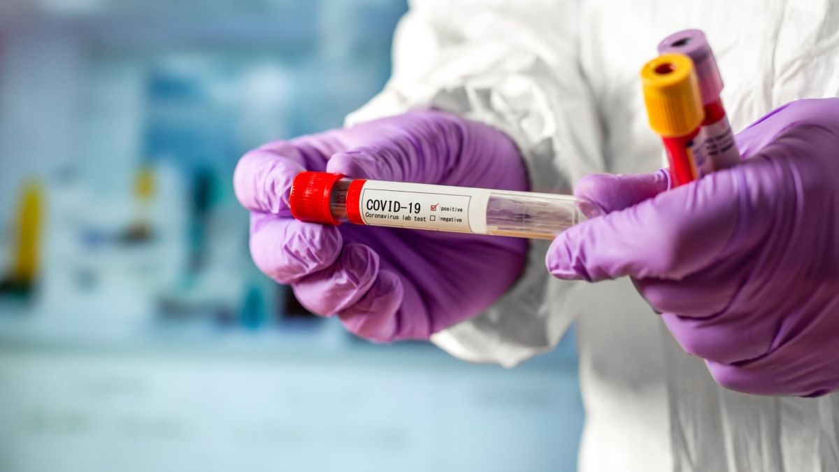 Де найбільше проводять тестів на COVID-19