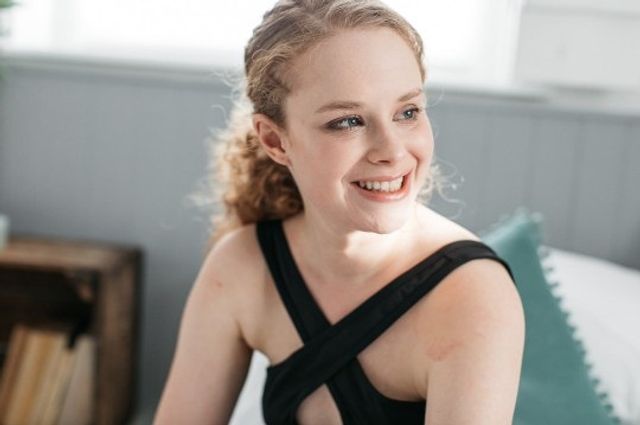 Моделі з дефектами шкіри знялися для реклами - фото 396652