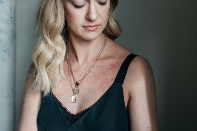 Моделі з дефектами шкіри знялися для реклами - фото 396655