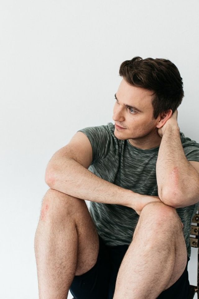 Моделі з дефектами шкіри знялися для реклами - фото 396657