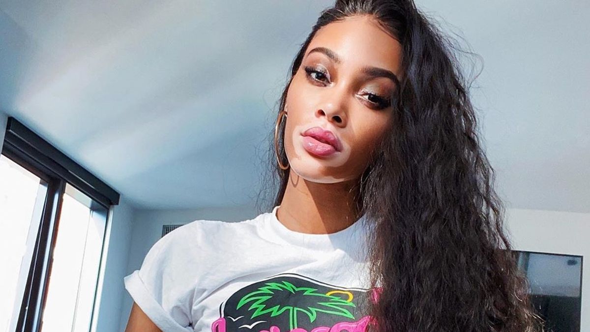 Відверта канадська модель з вітиліго похизувалася спокусливим тілом: пікантні кадри