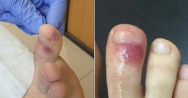 Медики повідомили про невідомий раніше симптом COVID-19 - фото 398415