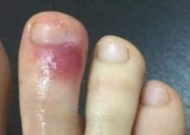 Медики повідомили про невідомий раніше симптом COVID-19 - фото 398416