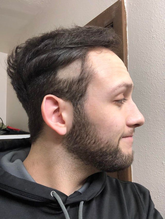 Сам собі перукар: фотодобірка невдалих стрижок, які люди зробили на карантині - фото 401089