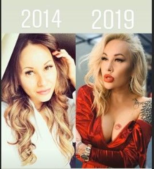 Скандальна Ірина Морозюк показала себе до та після пластики - фото 401454