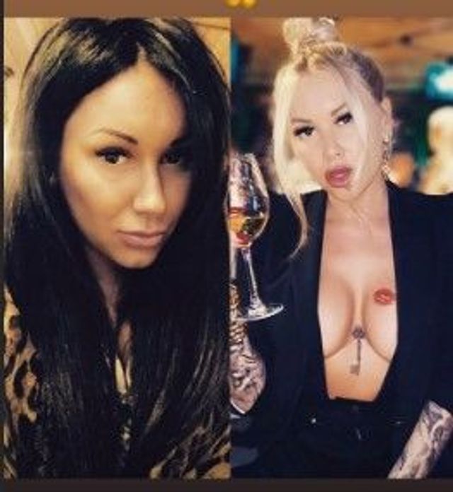 Скандальна Ірина Морозюк показала себе до та після пластики - фото 401456