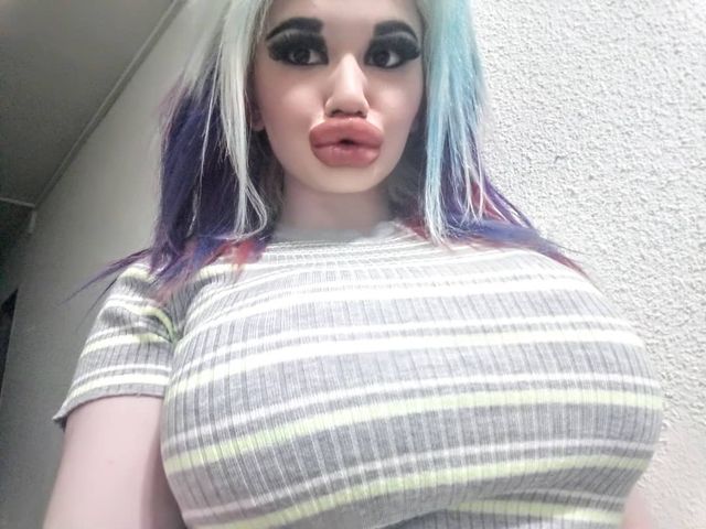 Дівчина зробила собі найбільші губи у світі: фотофакт - фото 402276