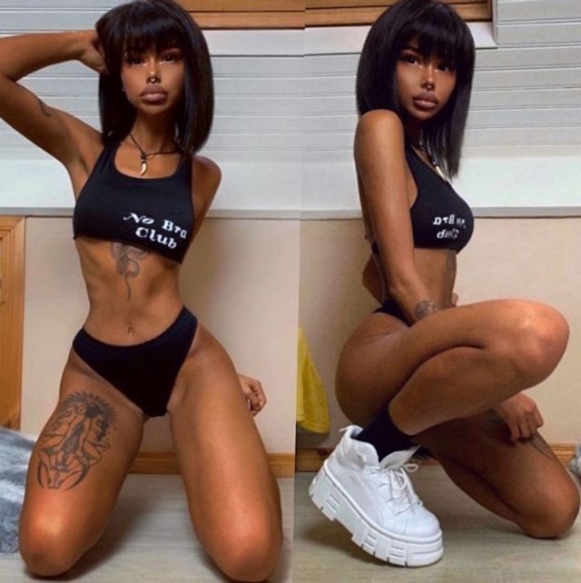 Дівчина, яка змінила колір шкіри, шокувала худорбою - фото 402669