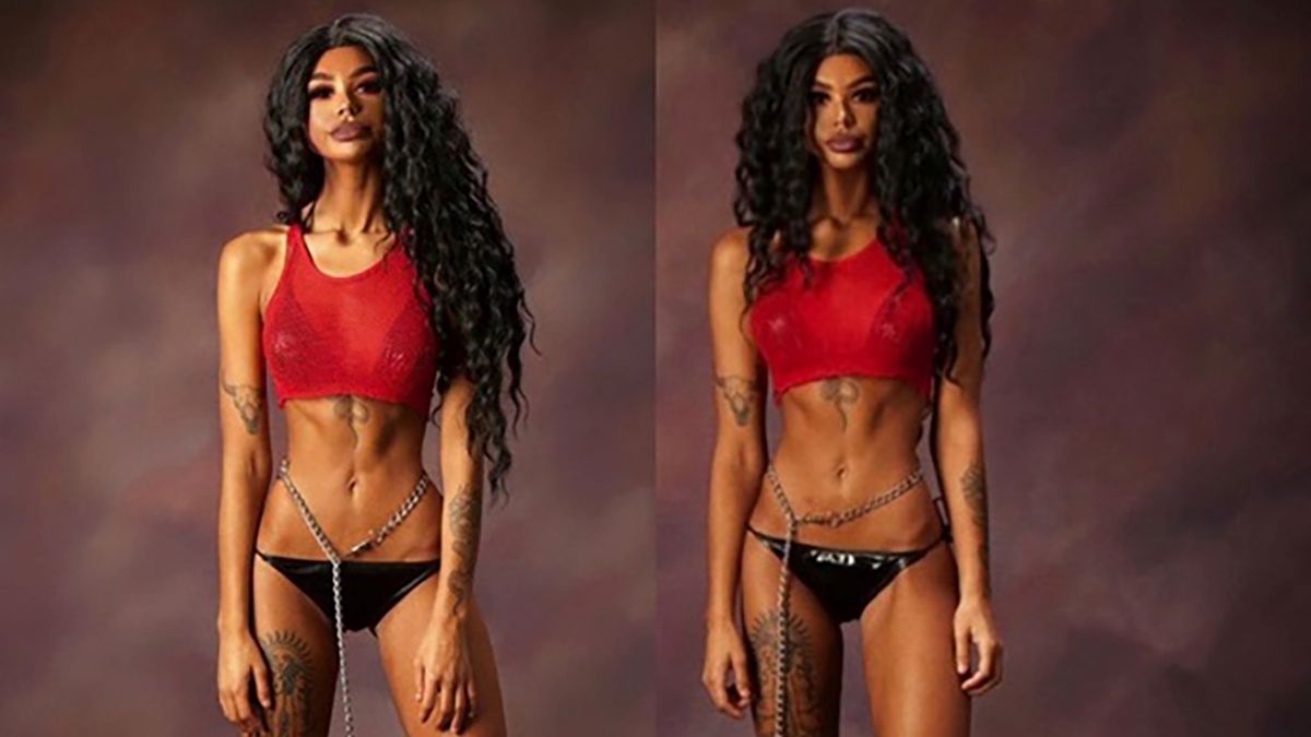 Дівчина, яка змінила колір шкіри, шокувала худорбою