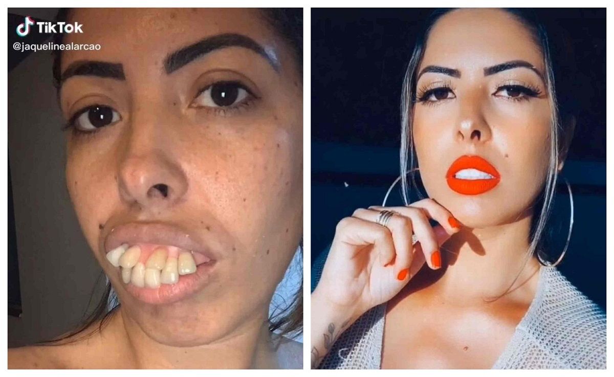 Блогерка шокувала своїм виглядом до - фото 1