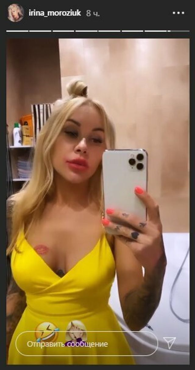 Скандальна Ірина Морозюк похизувалася сідницями у мінісукні - фото 408804