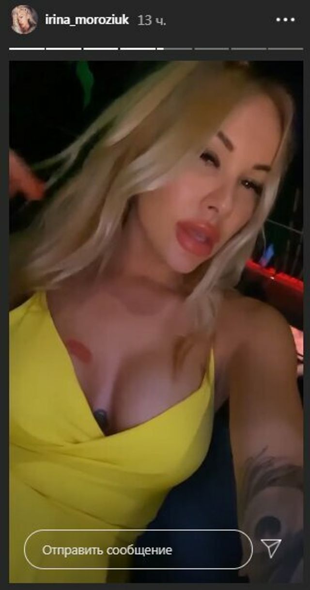 Скандальна Ірина Морозюк похизувалася сідницями у мінісукні - фото 408805