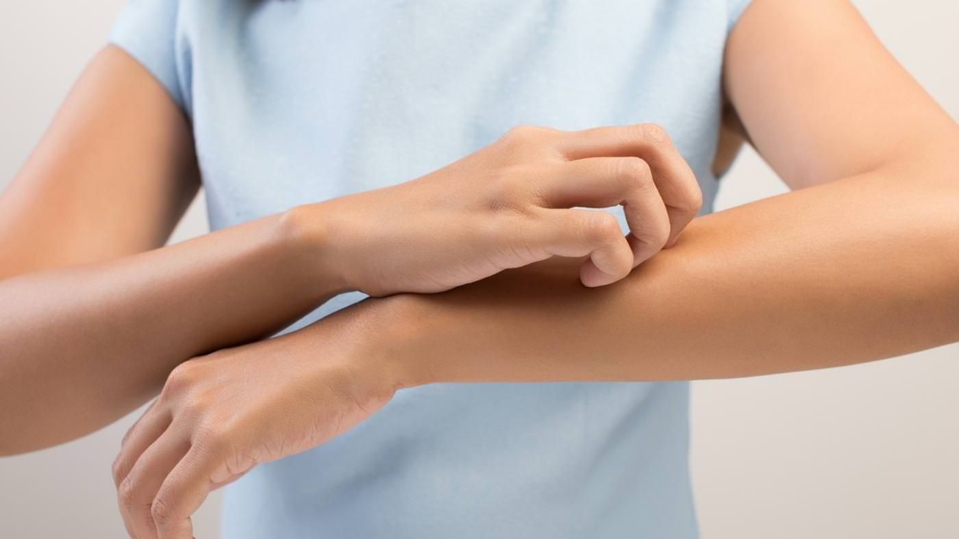 Як позбутися від свербіння після укусу комара: лайфхак з хвильовкою і рушником