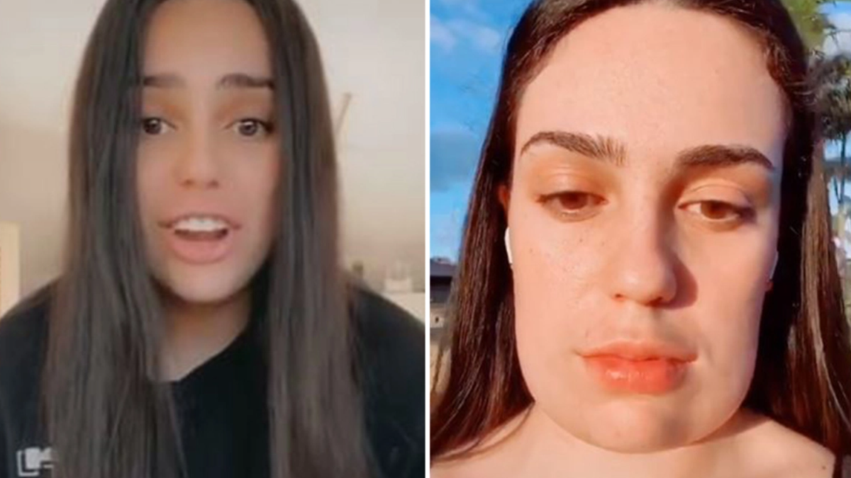 Ін'єкції краси зробили обличчя дівчини квадратним: відеофакт