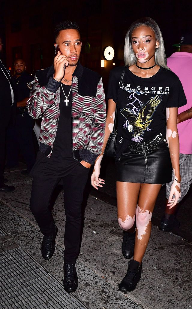 Як змінилася найсексуальніша модель з вітиліго Вінні Харлоу - фото 412242