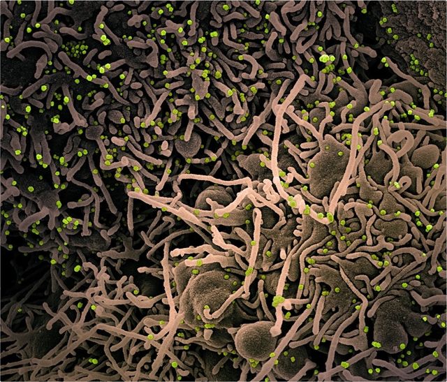 Як довго коронавірус живе у річковій воді - фото 412532