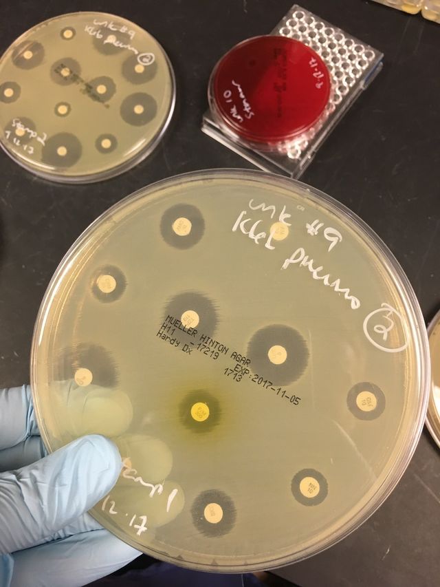 Вчений провів експеримент з медичною маскою і без неї: різниця колосальна - фото 413676