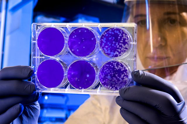 Коли може початись масова вакцинація проти коронавірусу - фото 416545