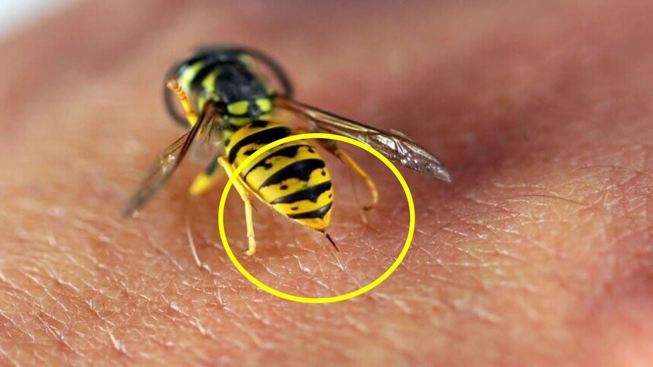 Що робити, якщо вкусила оса