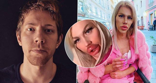 Фотограф з Чехії перетворився у ляльку Bratz завдяки пластиці (фото) - фото 420335