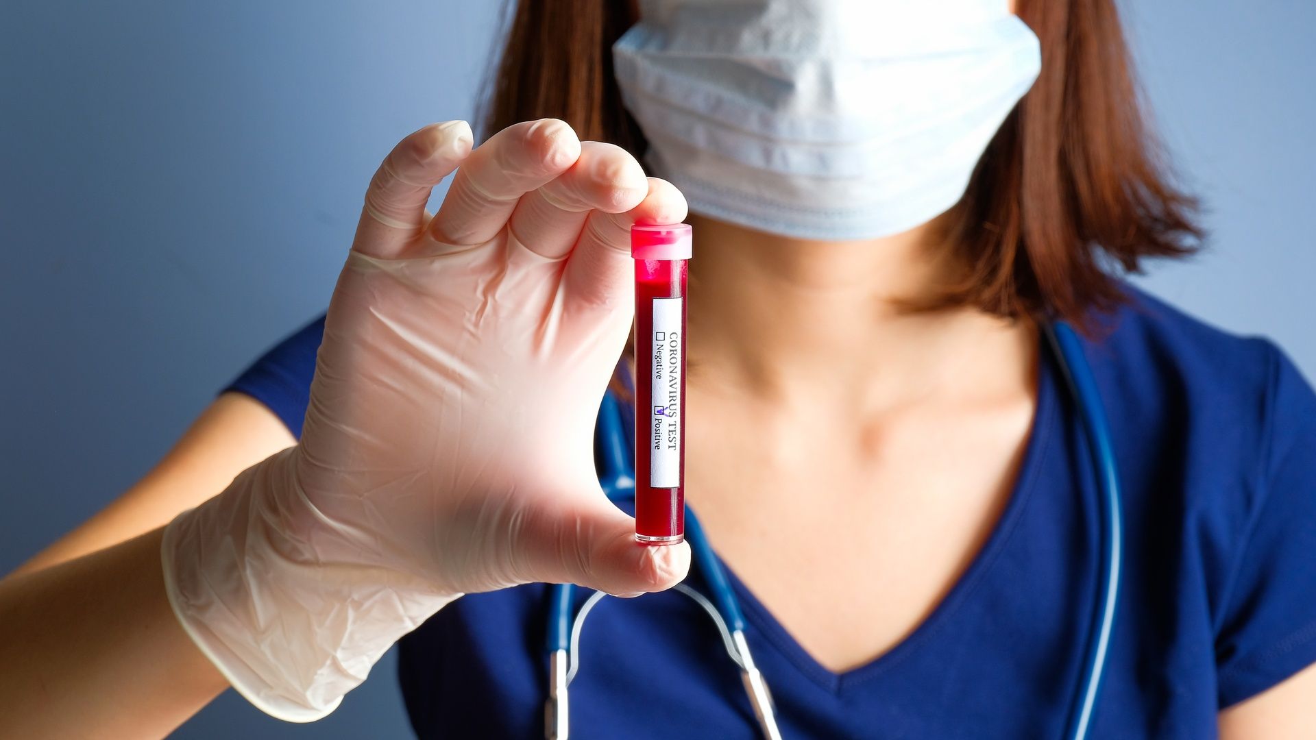 Новини про коронавірус в Україні: скільки хворих на Covid-19 станом на 16 серпня