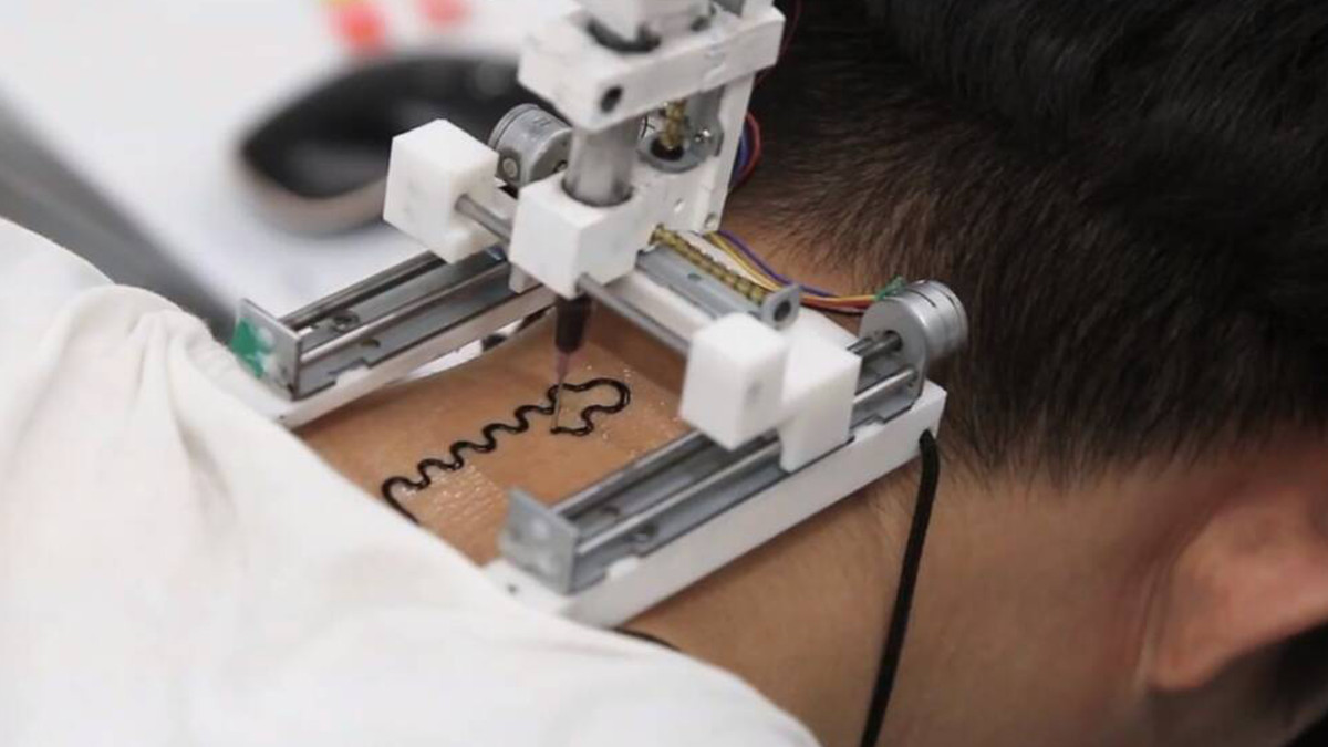 У мережі показали роботу 3D-принтера, який друкує на шкірі татуювання-датчики: відео - фото 1