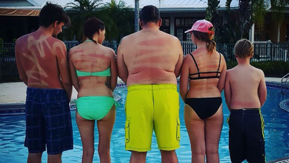 Користувачі мережі діляться смішними фото своєї невдалої засмаги: весела добірка