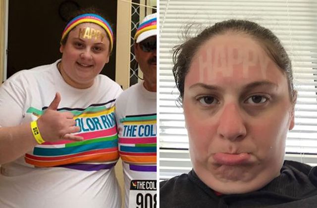 Користувачі мережі діляться смішними фото своєї невдалої засмаги: весела добірка - фото 421164