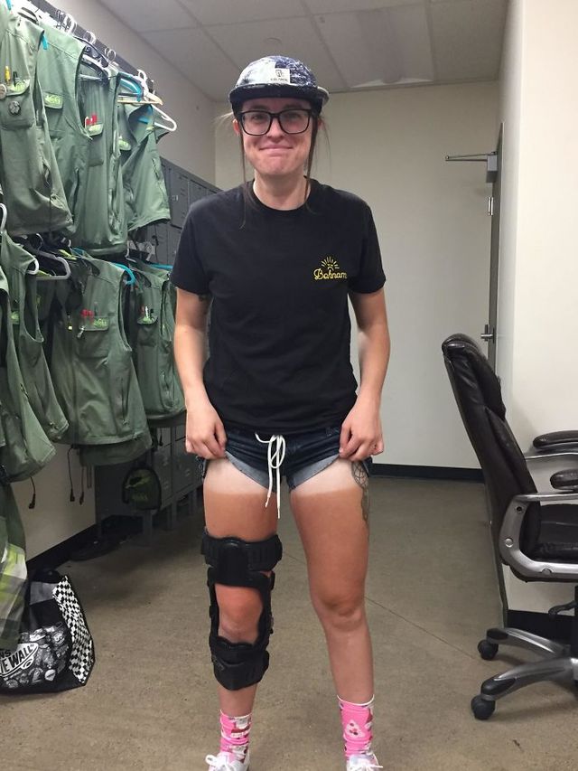 Користувачі мережі діляться смішними фото своєї невдалої засмаги: весела добірка - фото 421180