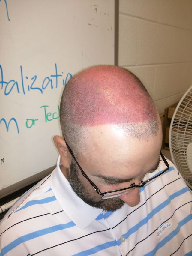 Користувачі мережі діляться смішними фото своєї невдалої засмаги: весела добірка - фото 421181