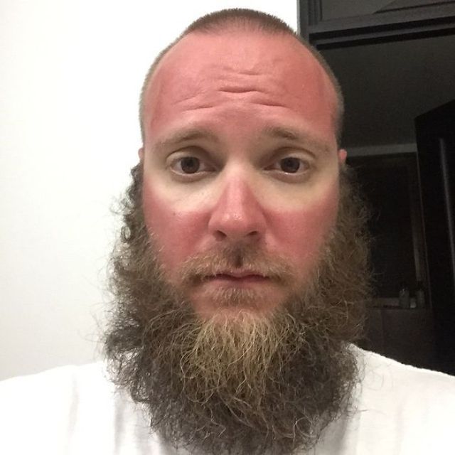 Користувачі мережі діляться смішними фото своєї невдалої засмаги: весела добірка - фото 421185