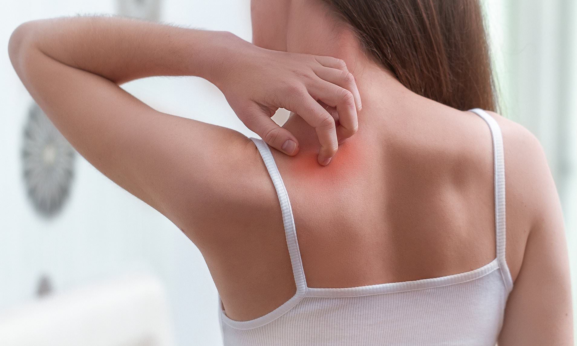 Вчені розповіли, як правильно вгамувати свербіння