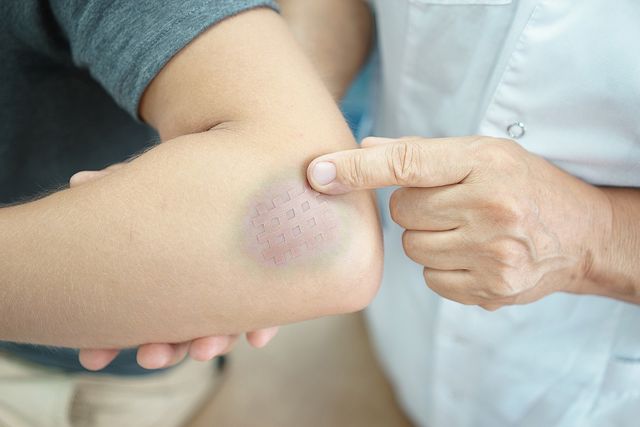 ТОП-4 способів нестандартного застосування горілки - фото 432075