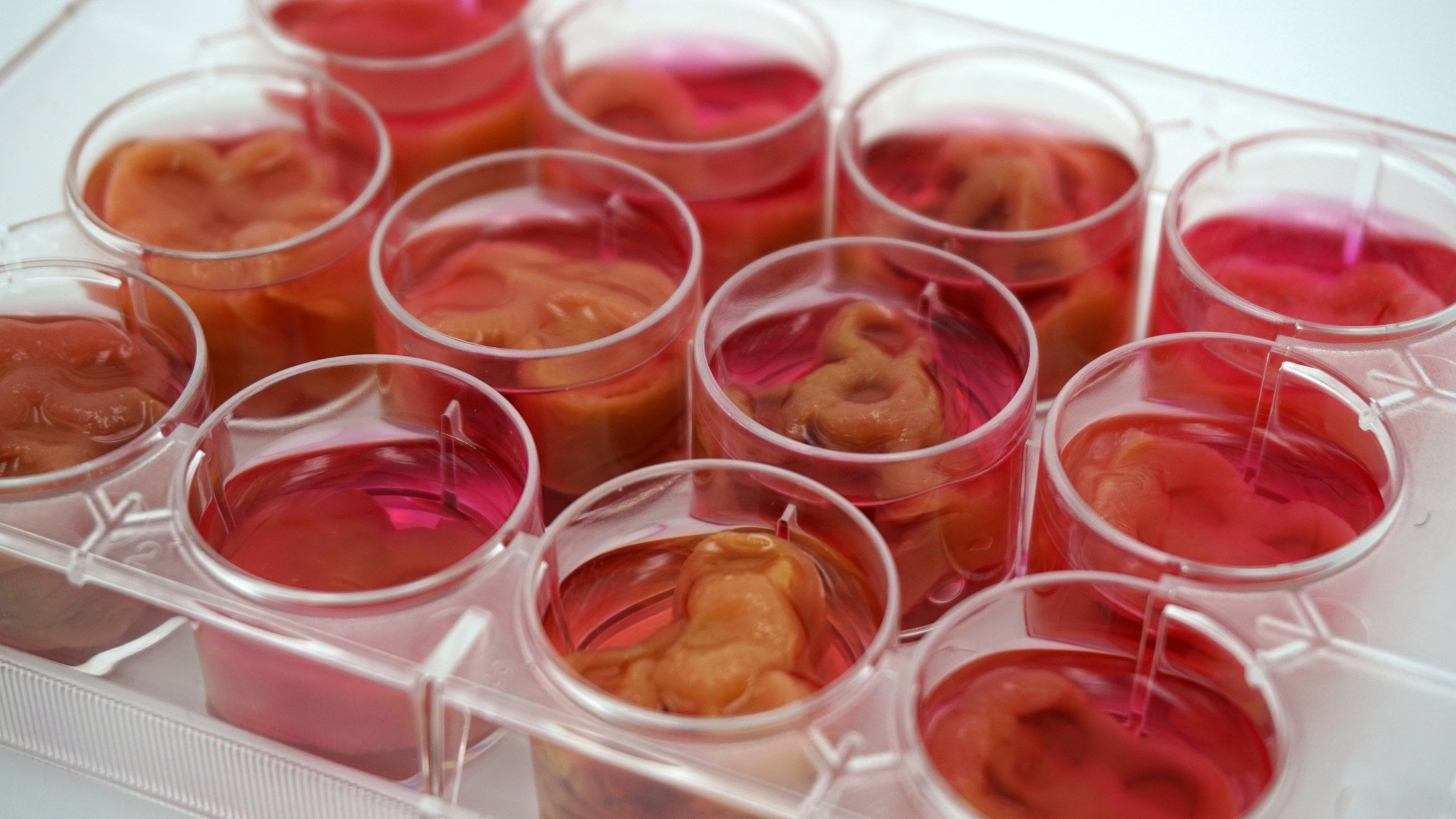 Учені створили м'ясо з клітин людського тіла і крові