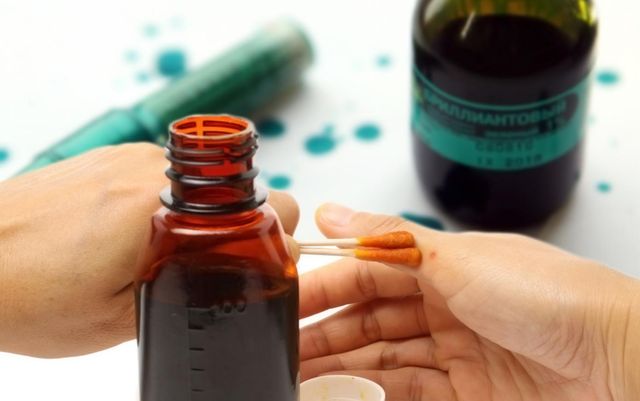 Декомунізація у вашій аптечці: Супрун розповіла, які засоби пора прибрати з полиць - фото 439368