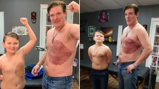 Канадець набив собі величезну родимку, щоб його маленький син позбувся комплексів - фото 439507