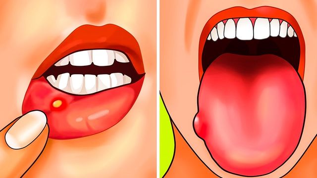 Чим загрожує дефіцит фолієвої кислоти в організмі - фото 440159