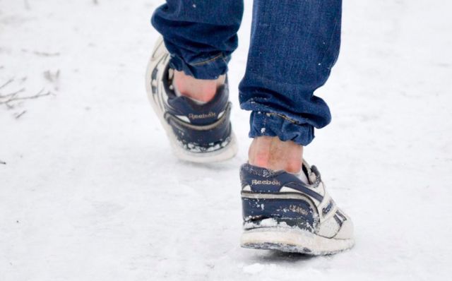 Ці деталі зимового гардероба виглядають безглуздо - фото 443264