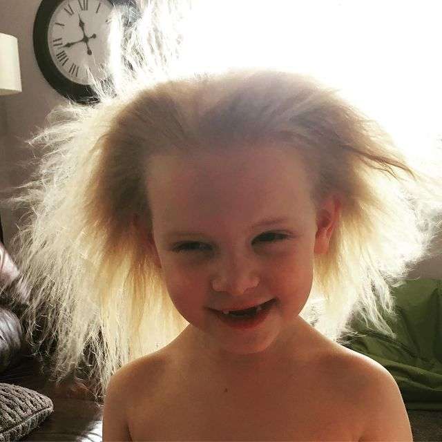 Дівчинка з синдромом неслухняного волосся вперше у житті зробила укладку: фото - фото 443620