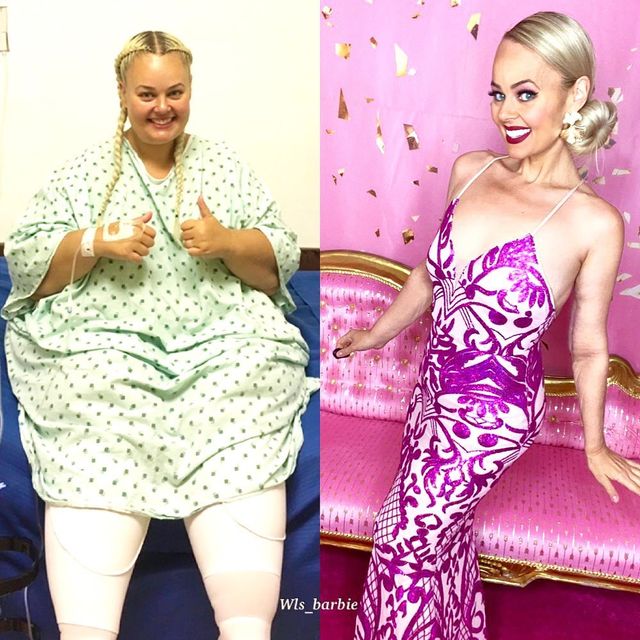 Австралійка вразила схудненням і стала реальною Барбі (фото) - фото 446852