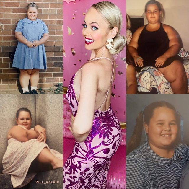 Австралійка вразила схудненням і стала реальною Барбі (фото) - фото 446855