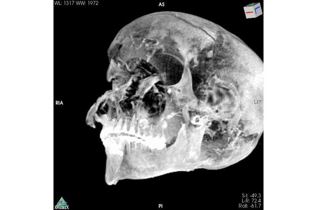 Вчені розгадати таємницю смерті одного з найвідоміших єгипетських фараонів - фото 448871