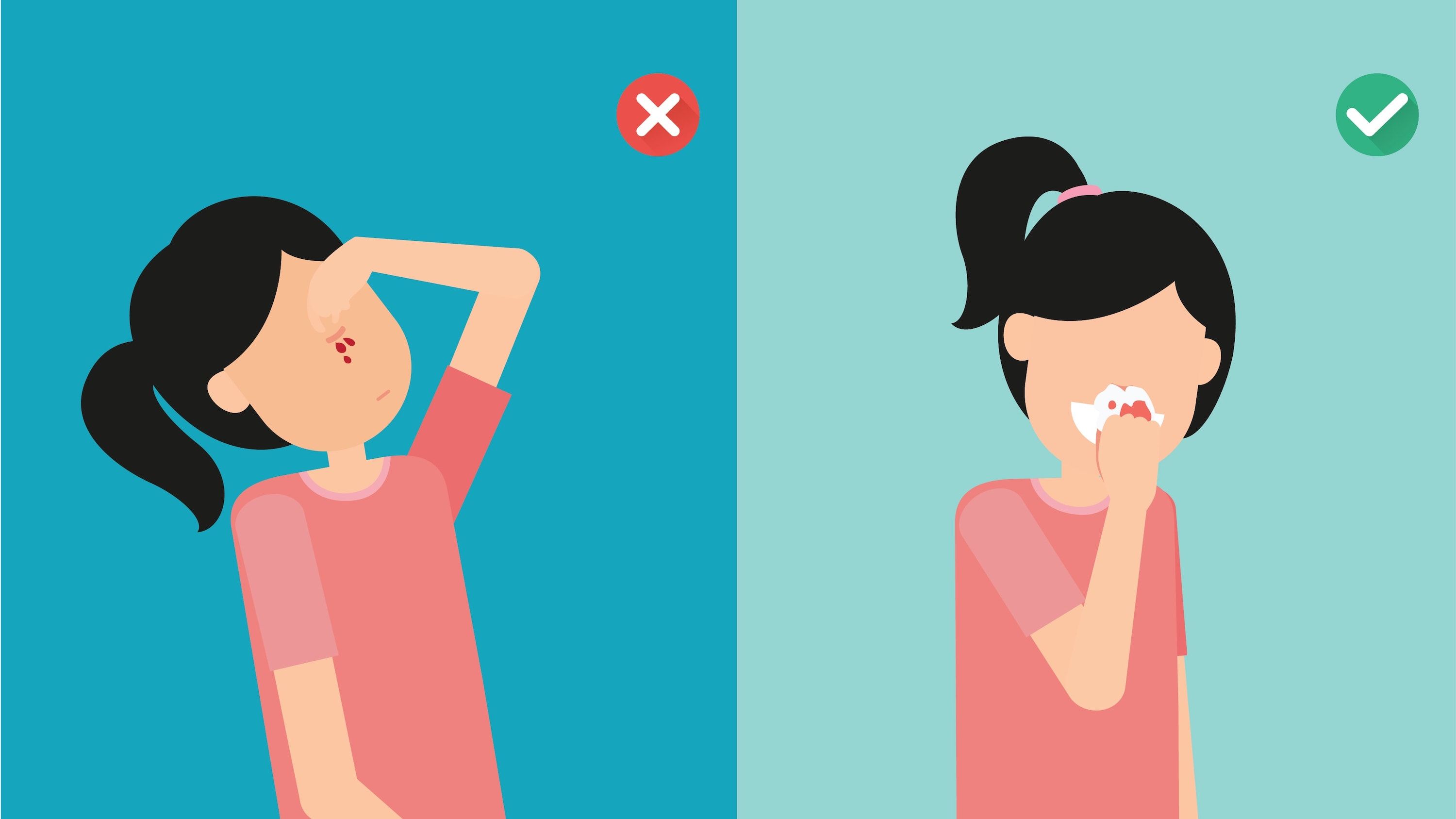 Як правильно зупиняти кров з носа - фото 1