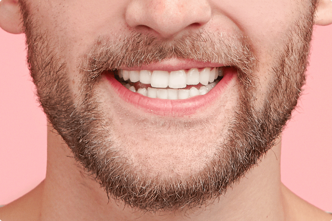 Зуби - фото 1