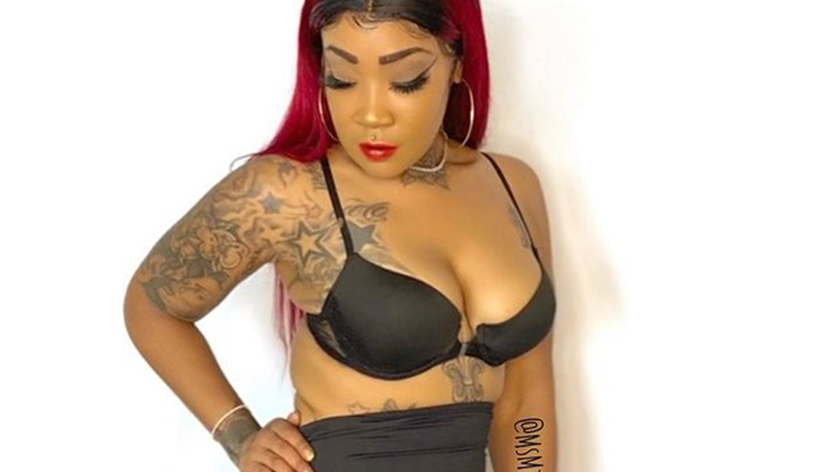 Жінка позбулася гігантських сідниць, прибравши з тіла силікон: фото ДО і ПІСЛЯ - фото 1