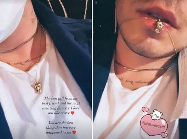 Бруклін Бекхем і його кохана зробили прикраси зі своїх зубів мудрості - фото 453593