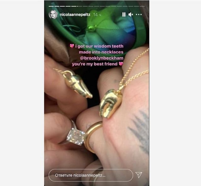 Бруклін Бекхем і його кохана зробили прикраси зі своїх зубів мудрості - фото 453594