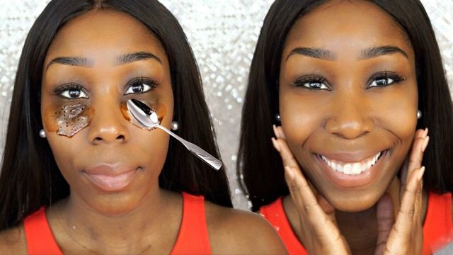 Дієтолог назвав спосіб позбутися мішків під очима - фото 454509