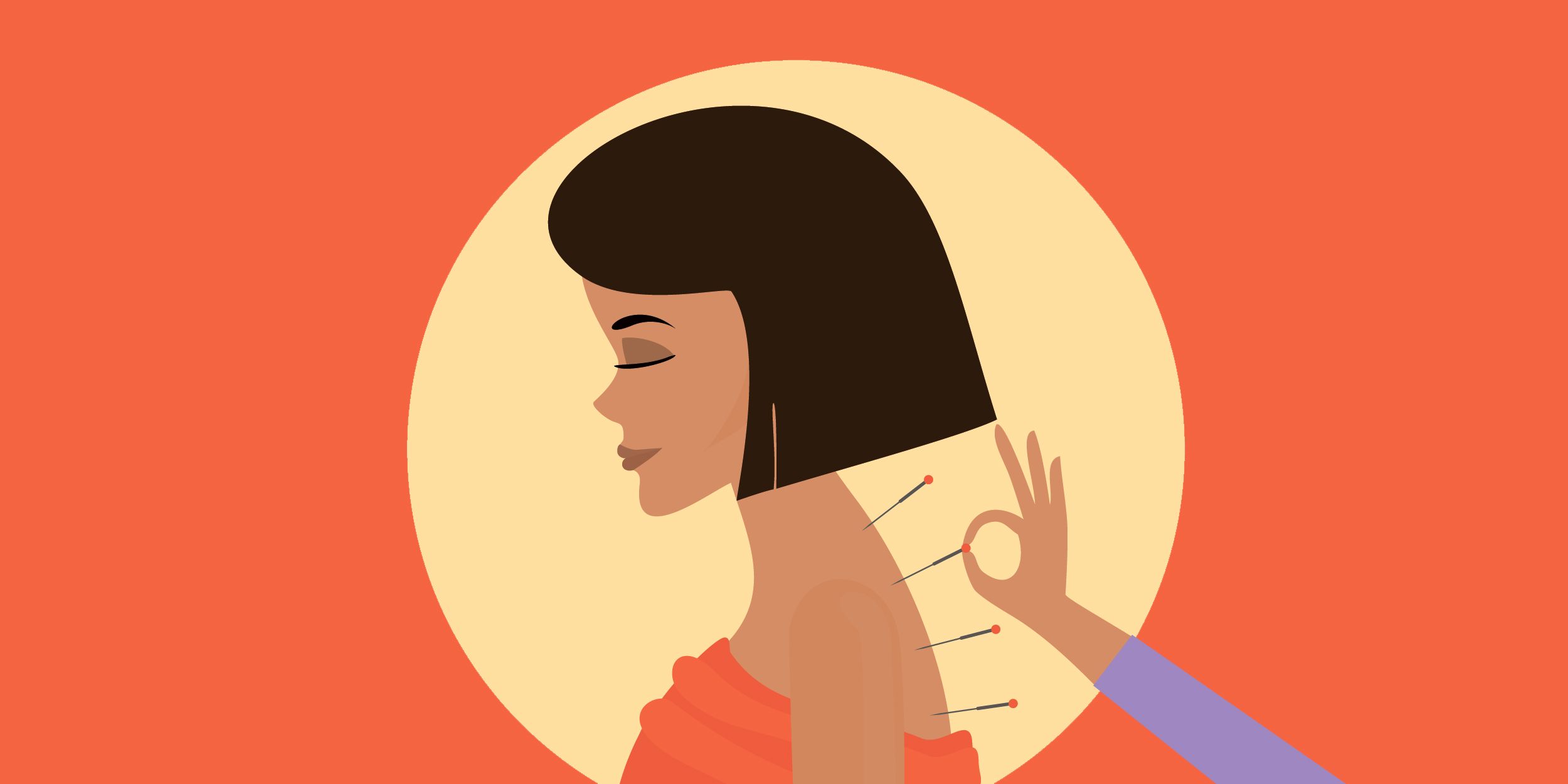 Що таке голковколювання і чи є від нього користь